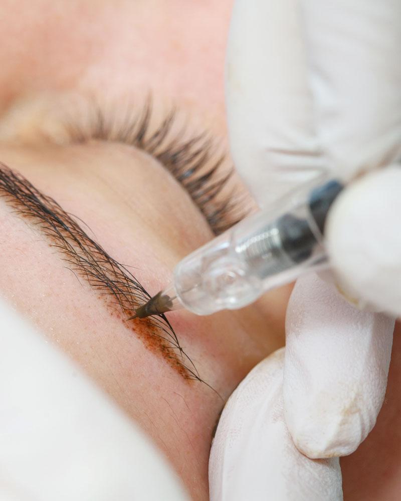 A close up of a hand holding a needle while tracing alongside a woman's eyebrow