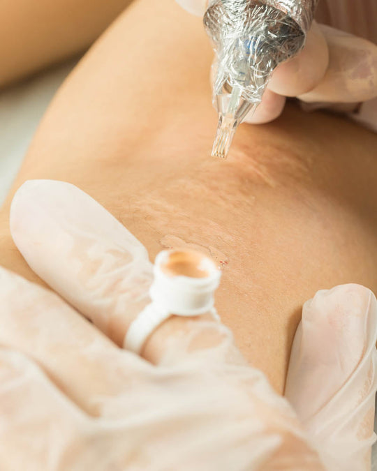 Camouflage, Scar Revision & Stretch Marks